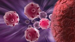 Krebszellen, Quelle: © vitanovski - fotolia.com